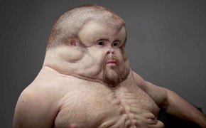 Graham Unfallforschung Graham Unfallforschung